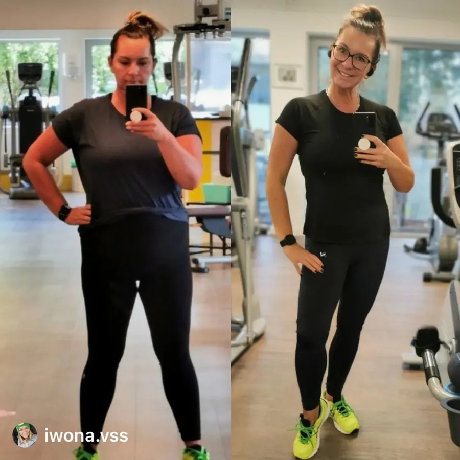 Iwona vorher und nachher